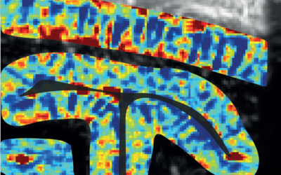 L’imagerie ultrasonore pour résoudre le fonctionnement du cortex visuel